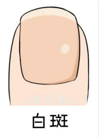 broken image